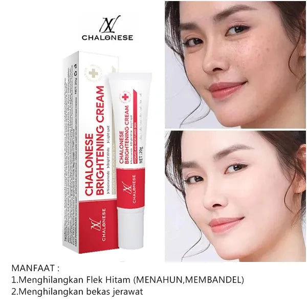 Chalonese Brightening Cream – Buy 1 Get 1 Free